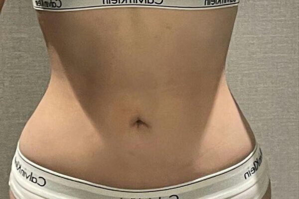 3개월차