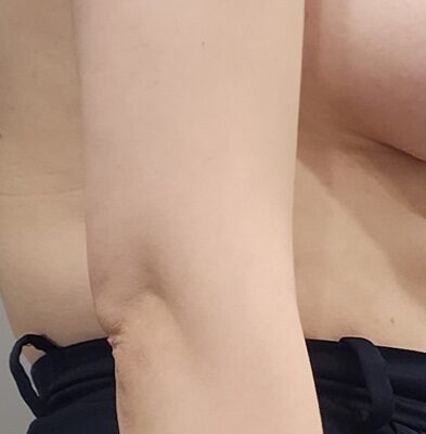 8개월차