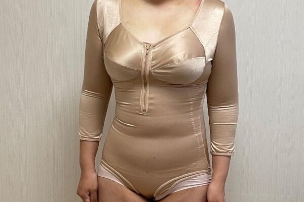 복부지흡3주 팔지흡1일차