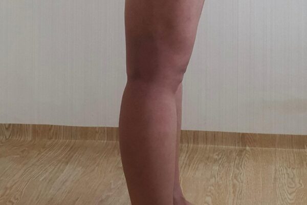 복부9주차 팔6주차 허엉무4주차