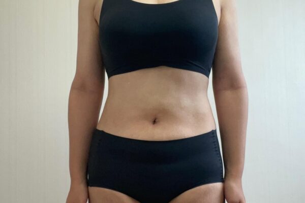 복부3개월차 허엉무2개월차